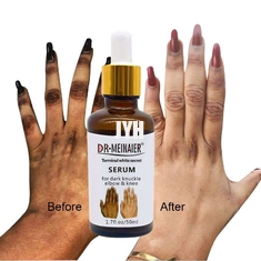 GMPC Bodycare Cosmetics Whitening Hand Knuckle Glow Serum For Removing Dark Knuckle Elbow
