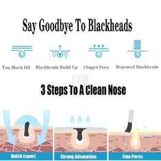 500ml OEM Skin Care Products Acne Shrink Coarse Pores Beauty Salon Blackheads Liquid Remover For Nose