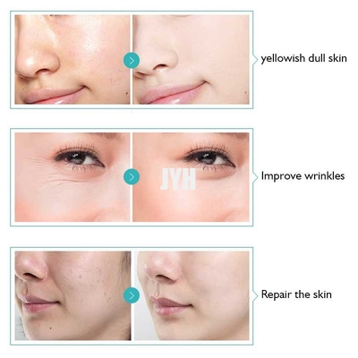 Apple Stem Cell Wrinkle Removal Serum Antioxidant Serum For Sensitive Skin