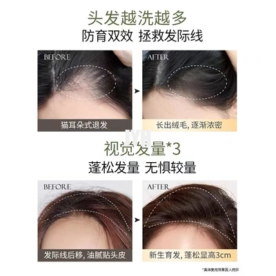 400ml ODM Organic Shampoo Natural Shower Gel For Hair Growth Set