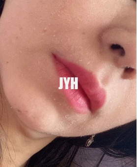10% Glycolic Acid Hydrating Facial Toner 100ml Skincare Chemical Peel Brighten Skin