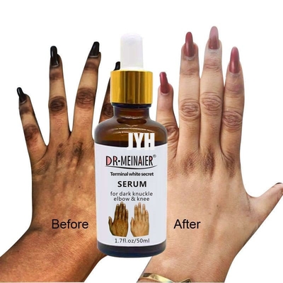 GMPC Bodycare Cosmetics Whitening Hand Knuckle Glow Serum For Removing Dark Knuckle Elbow
