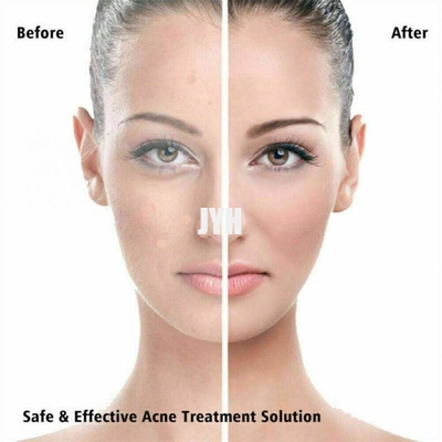 Vegan Friendly Hydrocolloid Acne Pimple Patch For Covering Zits