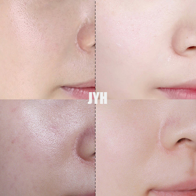 30g Ultimate Spot Cream Acne Treatment Brighten And Repair Face Cream