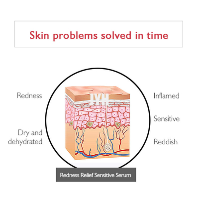 Oem Private Label Organic Anti-Redness Serum For Reducing Redness Facial Serum