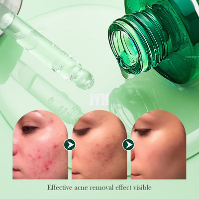 30ml Brightening Antioxidant Tea Tree Serum Skincare Facia Hydrating Oil Control