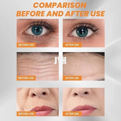 3 Pcs / Set Dissolving Collagen Mask For Face With Hyaluronic Acid Collagen Peptides
