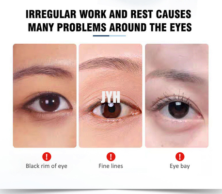 15ml OEM Skin Care Products Revitalizing Anti Aging Eyebag Removal Eye Cream